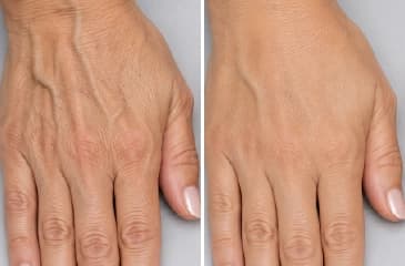 Hands