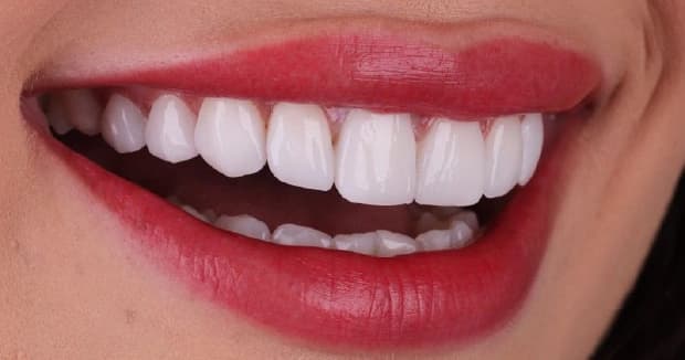 Benefits and long-term value of dental treatments