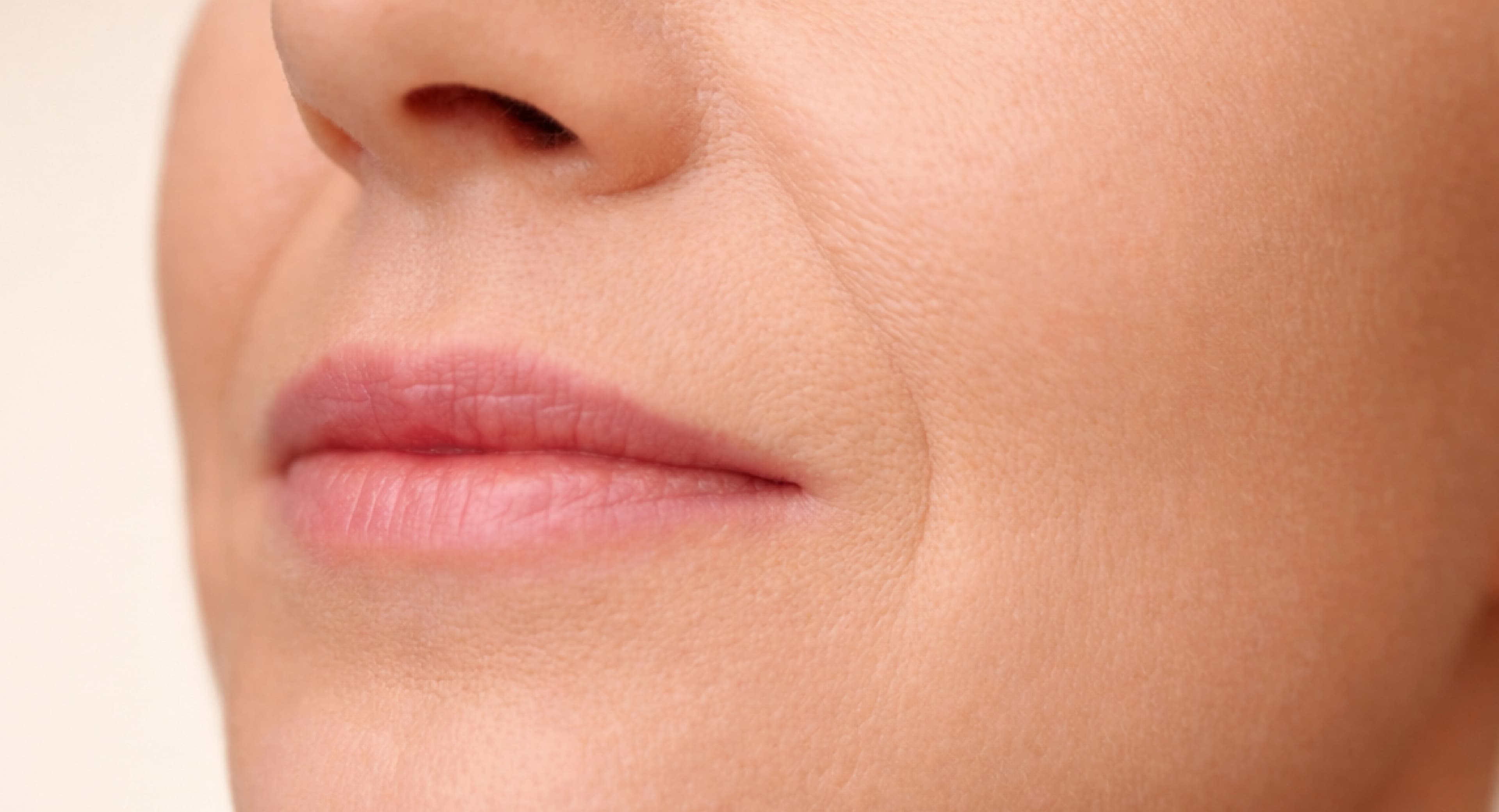 Nasolabial Folds