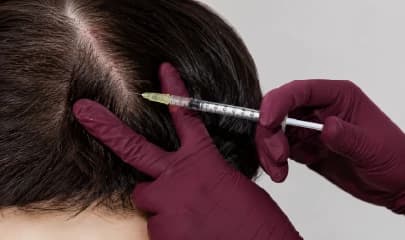 Hair and Scalp Care