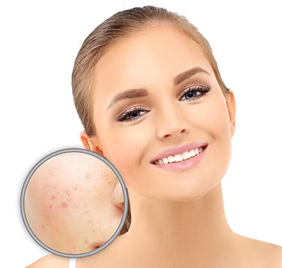 Pigmentation/Hyperpigmentation
