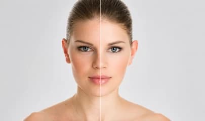 Skin Rejuvenation