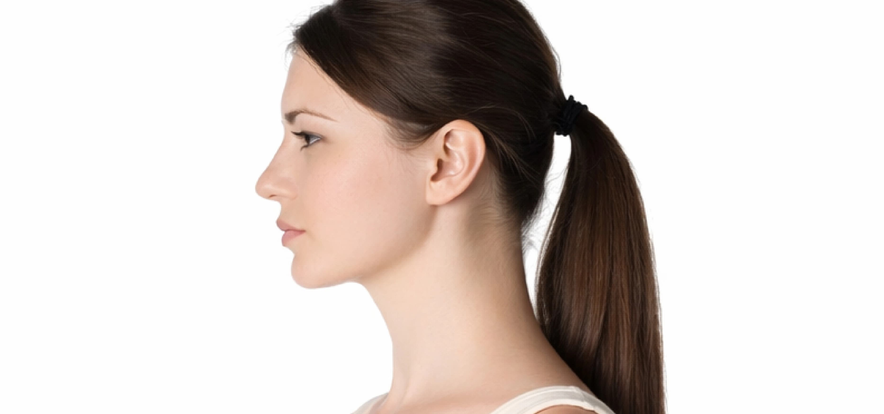 Double Chin Reduction after result