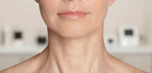 Upper Neck Tightening