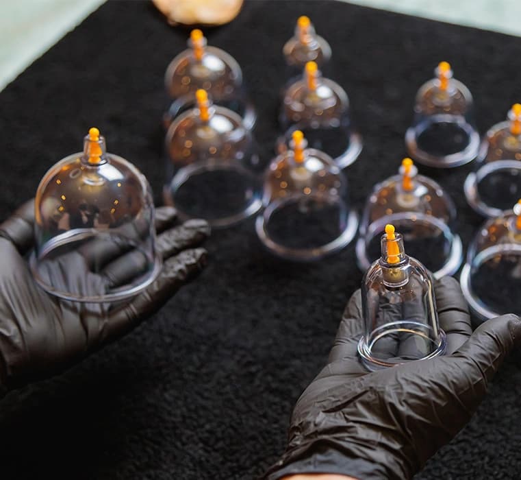 Hijama Therapy Benefits