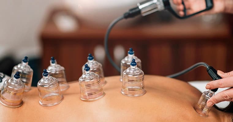 Hijama at Amara