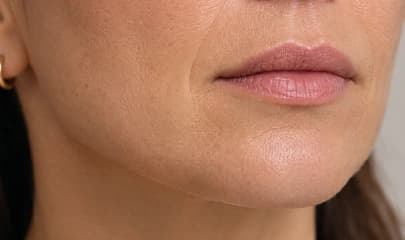 Chin & Jawline