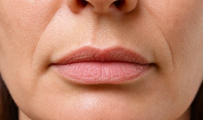 Lips & Around the Mouth