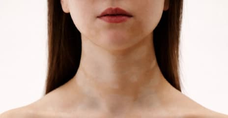 Neck and Décolletage