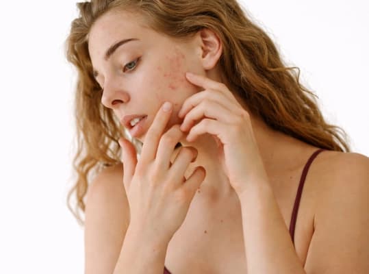 Pigmentation Treatment candidate