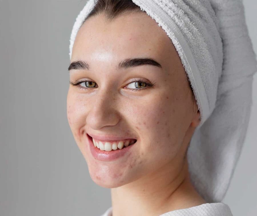 Why Choose Amara Aesthetic Studio for Pigmentation Treatment