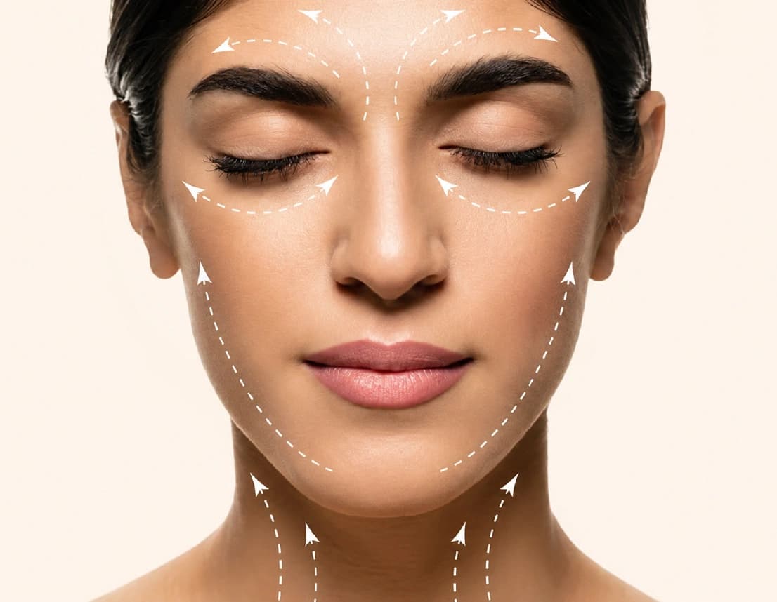 Radiesse injections treatment areas in Dubai