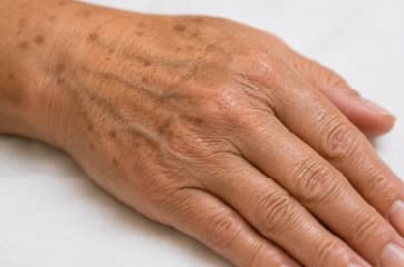 Hands