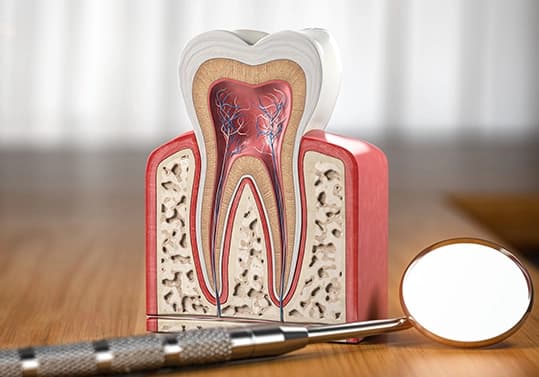 Root Canal Symptoms