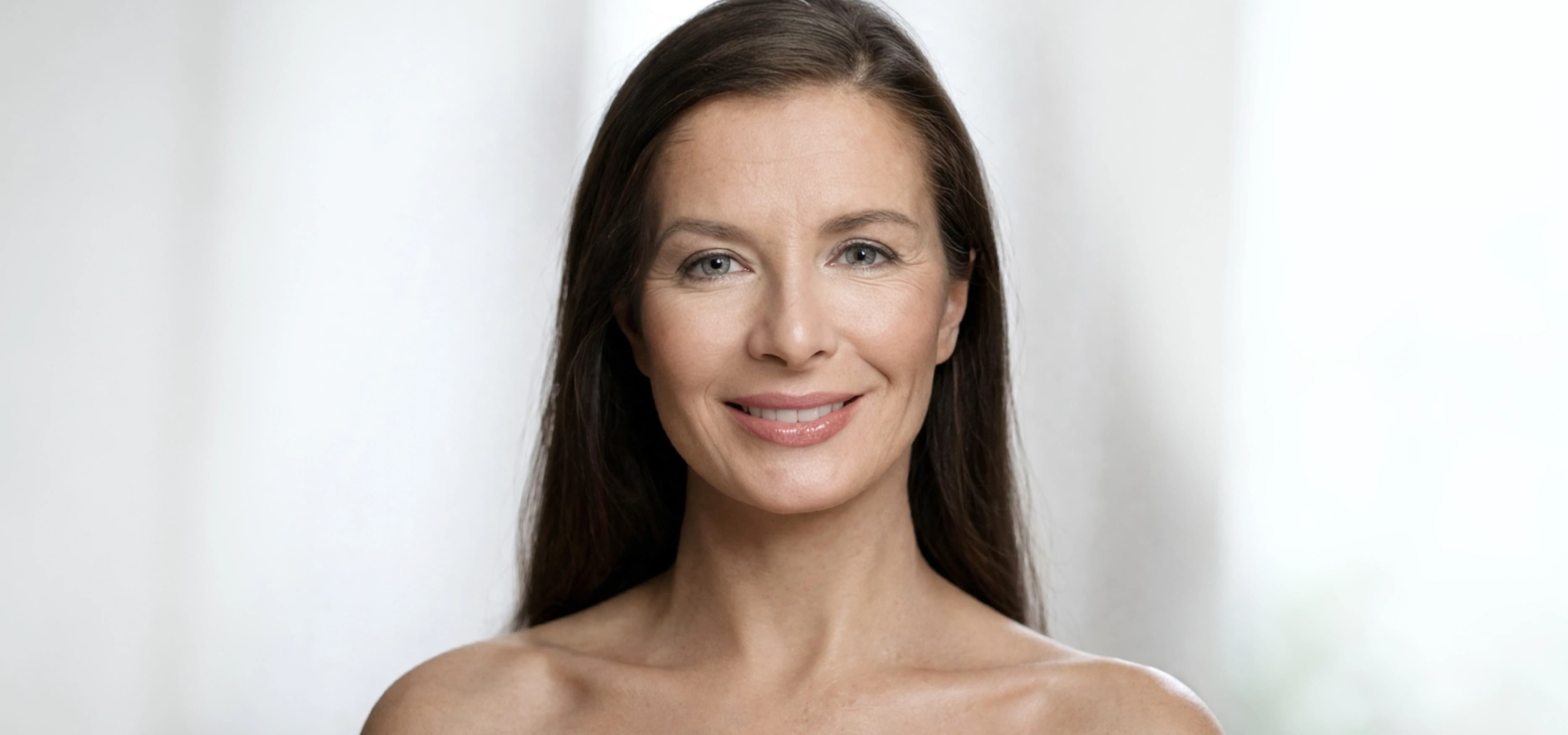 Sculptra before result