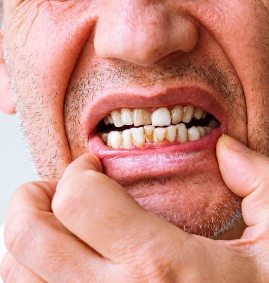 Teeth whitening treatment consultation at Amara