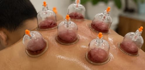 Back & Shoulder Wet Cupping