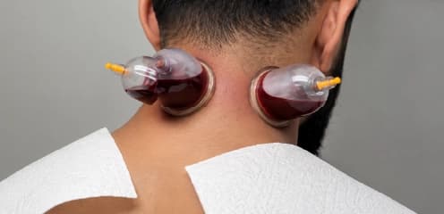 Neck & Upper Body Wet Cupping