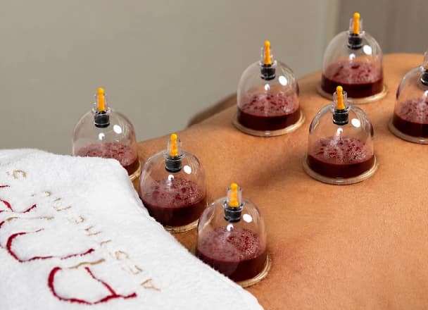Professional Wet Cupping at Amara Aesthetic Studio