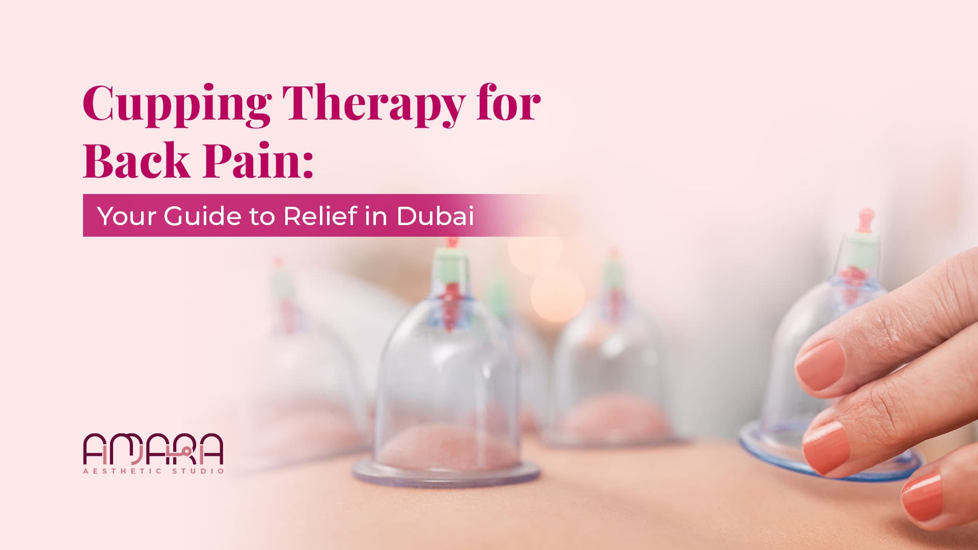 Cupping Therapy for Back Pain: Your Guide to Relief in Dubai  