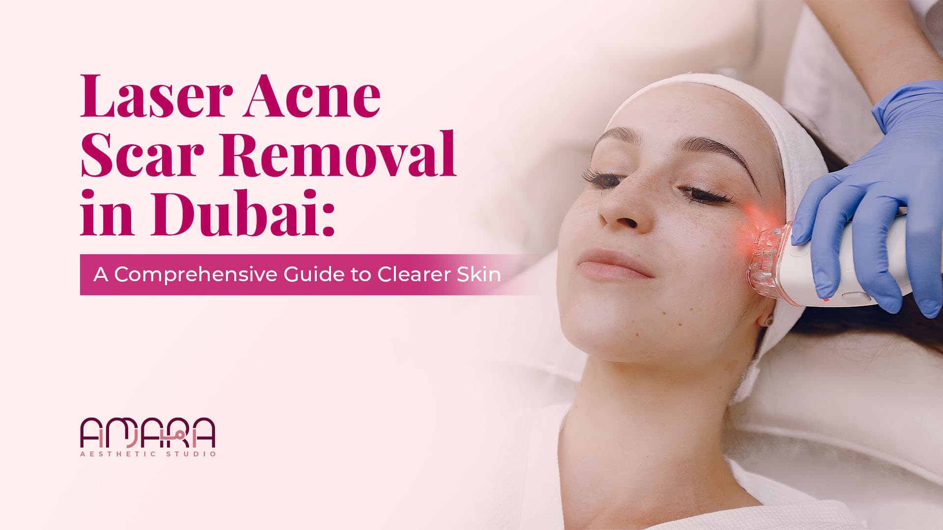 Laser Acne Scar Removal in Dubai: A Comprehensive Guide to Clearer Skin 
