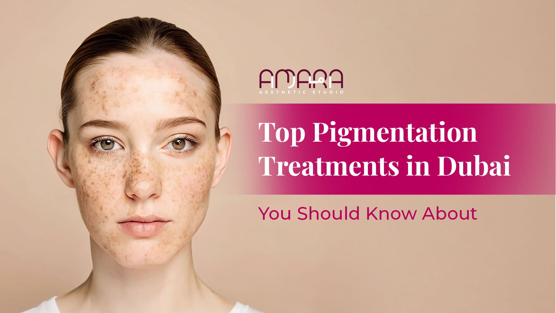 Top Pigmentation Treatments in Dubai You Should Know About 