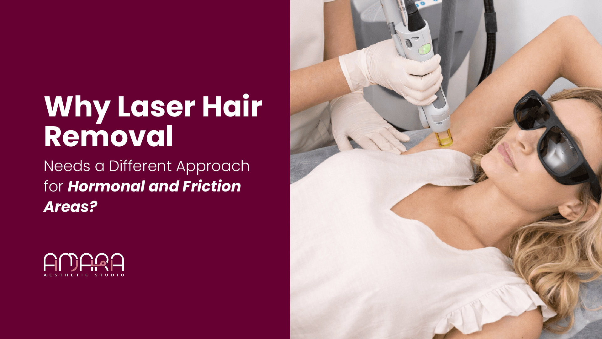 Why Laser Hair Removal Needs a Different Approach for Hormonal and Friction Areas? 