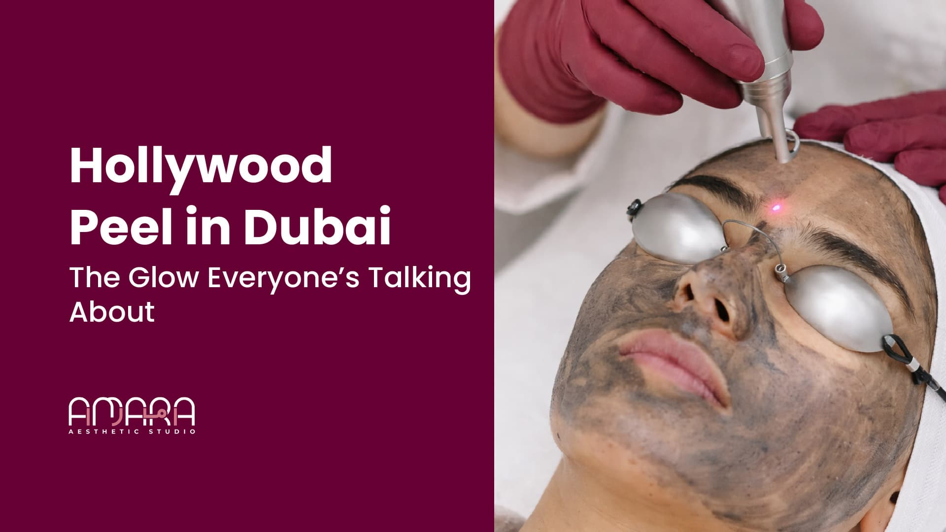 Hollywood Peel in Dubai: The Glow Everyone’s Talking About