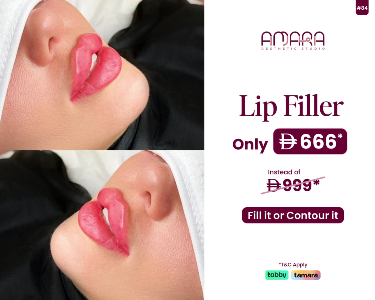 Lip Filler – Fill It or Contour It