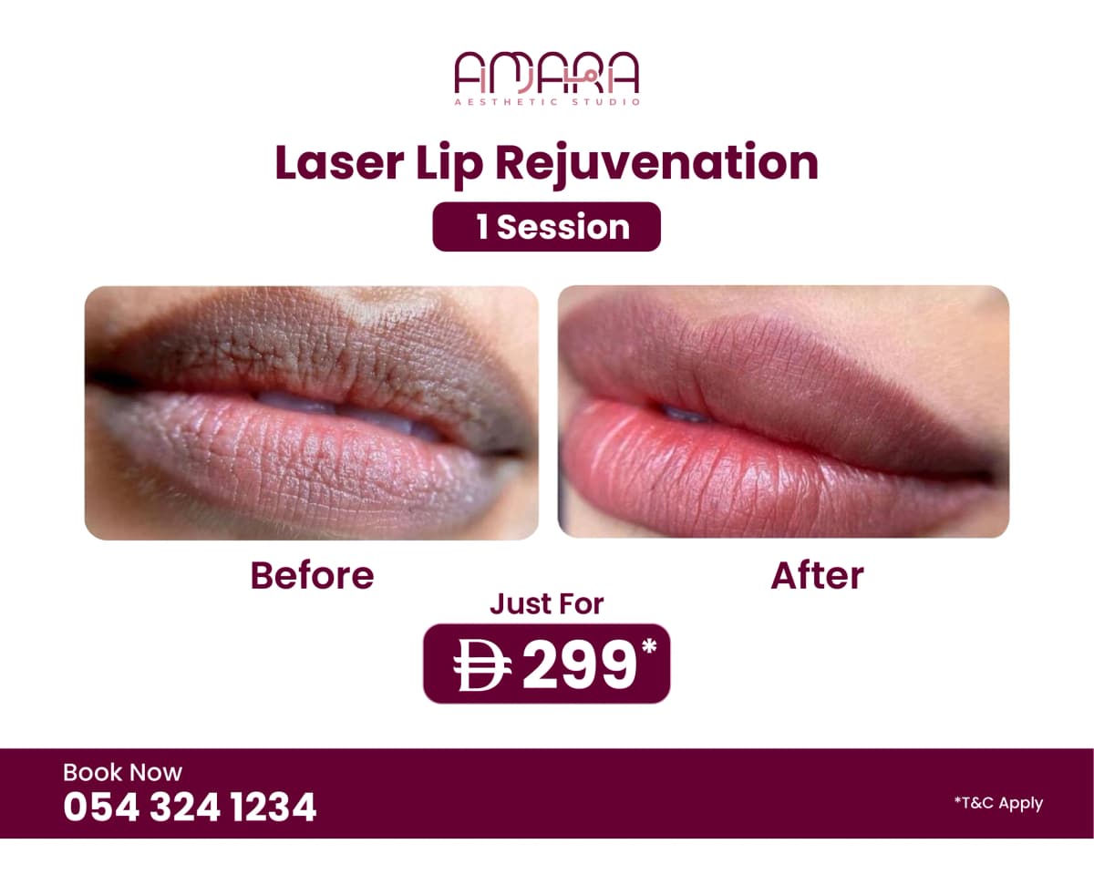 Laser Lip Rejuvenation – 1 Session