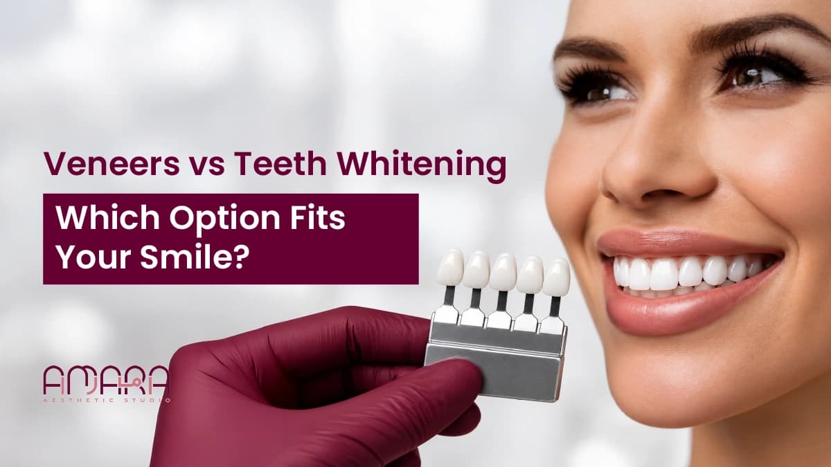 Veneers vs Teeth Whitening: Which Option Fits Your Smile?