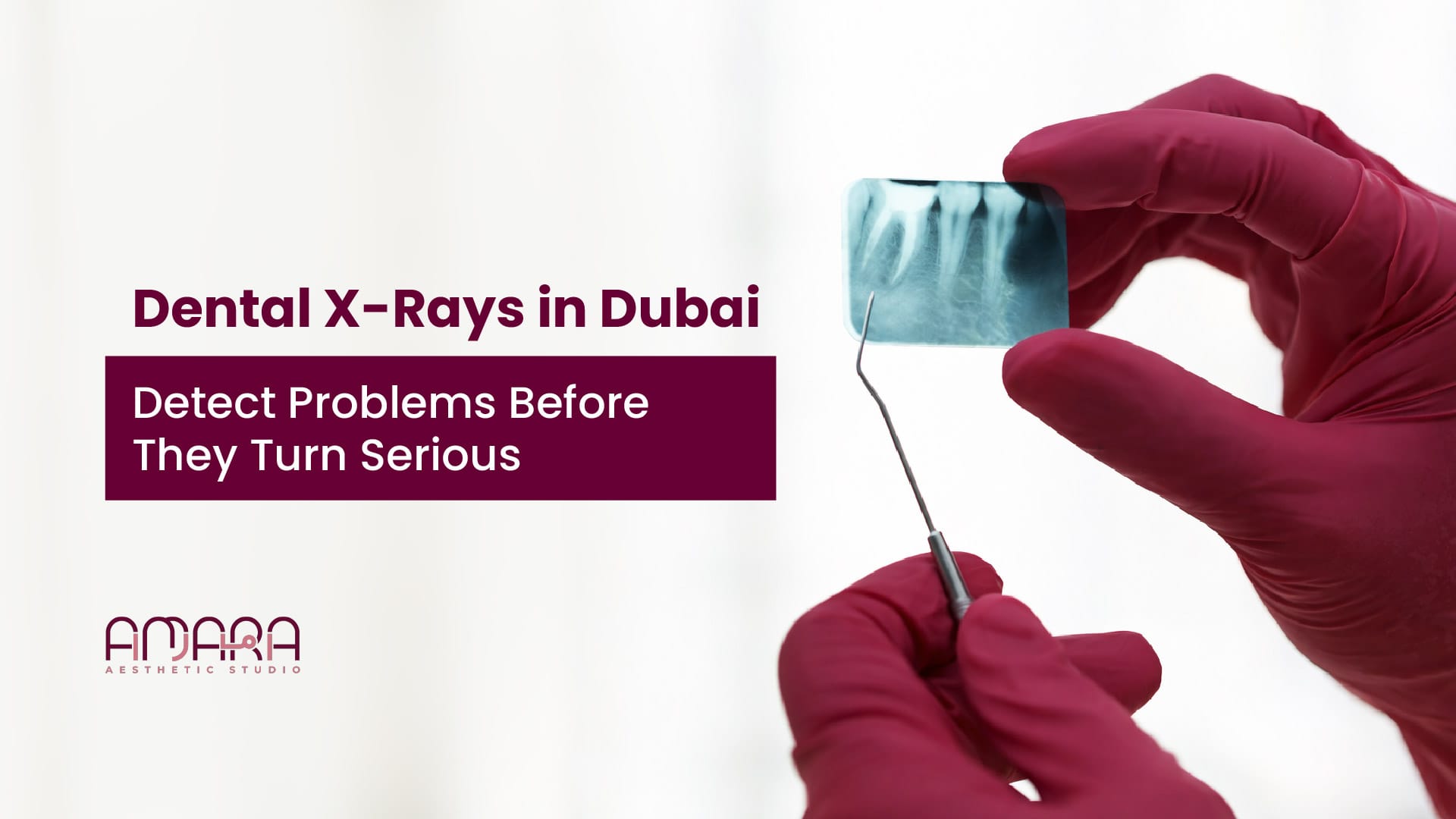 Dental X-Rays in Dubai: Detect Problems Before They Turn Serious