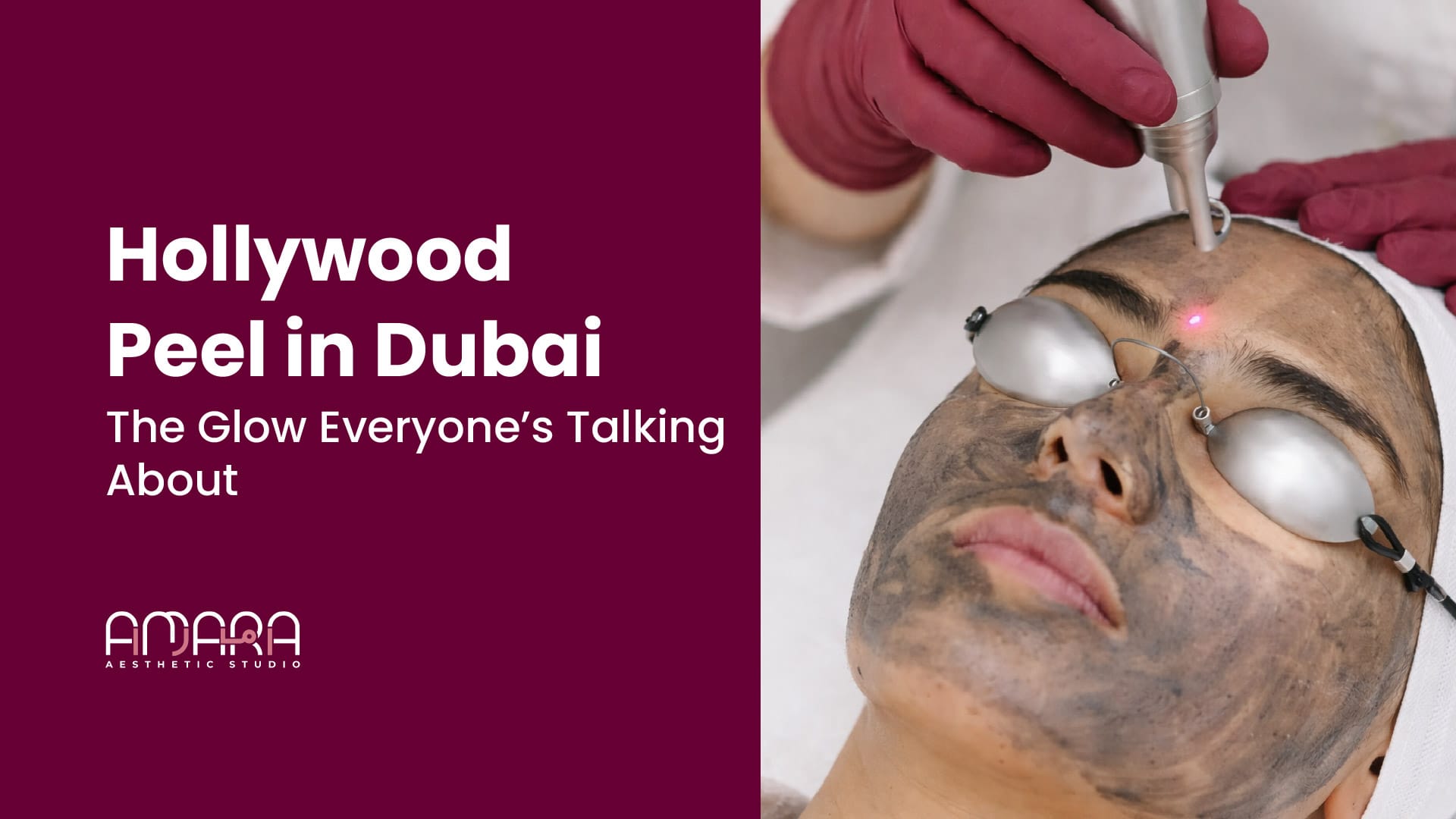 Hollywood Peel in Dubai: The Glow Everyone’s Talking About