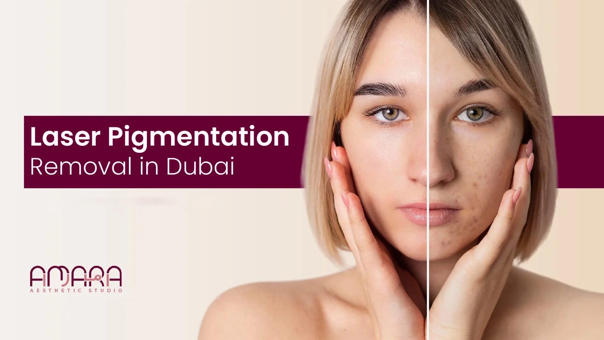 Laser Pigmentation Removal in Dubai