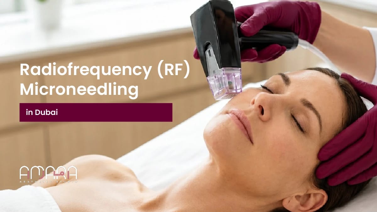Radiofrequency (RF) Microneedling in Dubai 