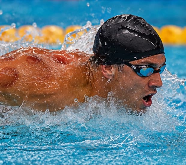 Cupping therapy benefits