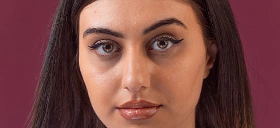 Dark Circles
