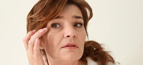 Puffiness & Eye Bags