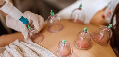 Back & Shoulder Hijama