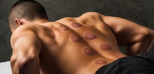 Sports Recovery Hijama