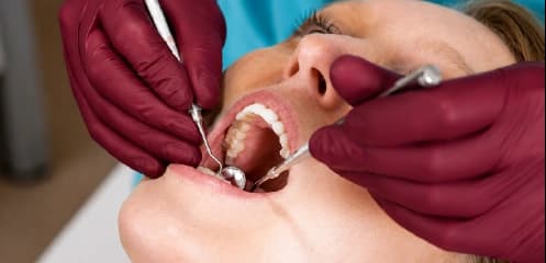 Protecting Weakened Teeth
