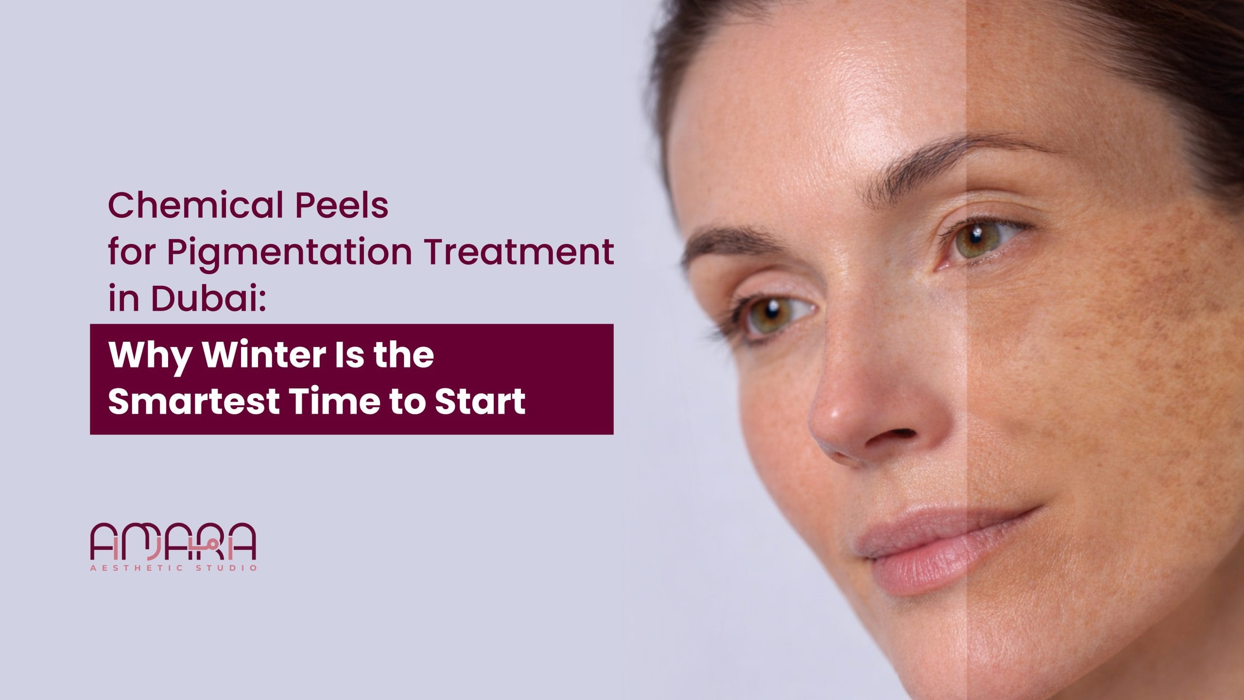 Chemical Peels for Pigmentation Treatment in Dubai: Why Winter Is the Smartest Time to Start