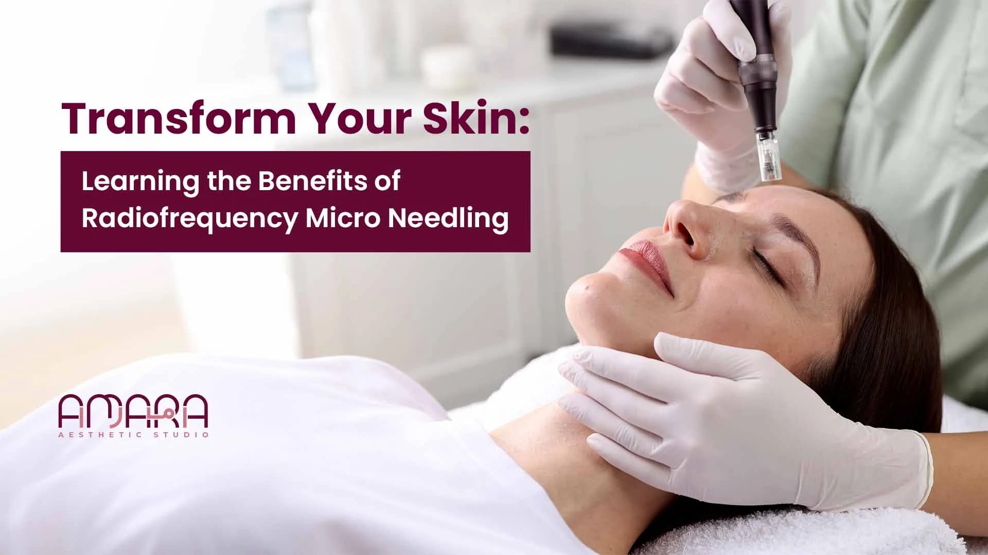 Top 6 Benefits of RF Microneedling in Dubai
