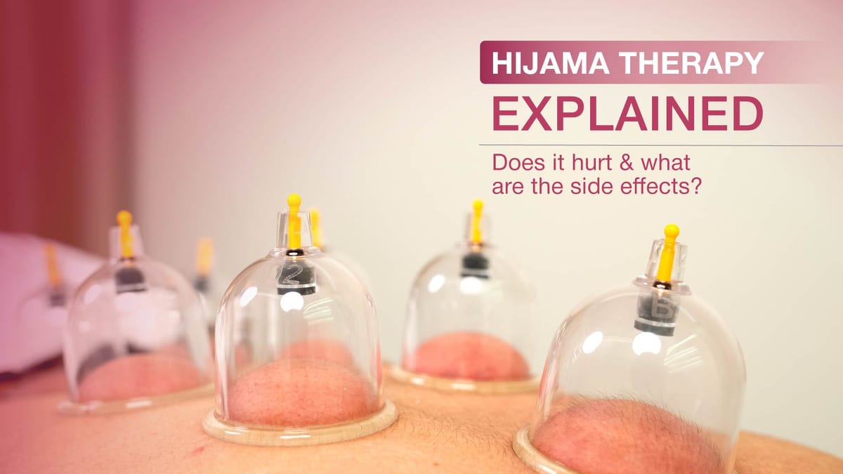 Hijama Side Effects Explained Risks Benefits Safety Tips hijama-side-effects-explained-risks-benefits-safety-tips