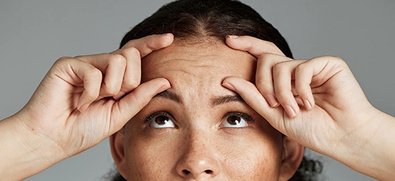 Fine Lines and Wrinkles